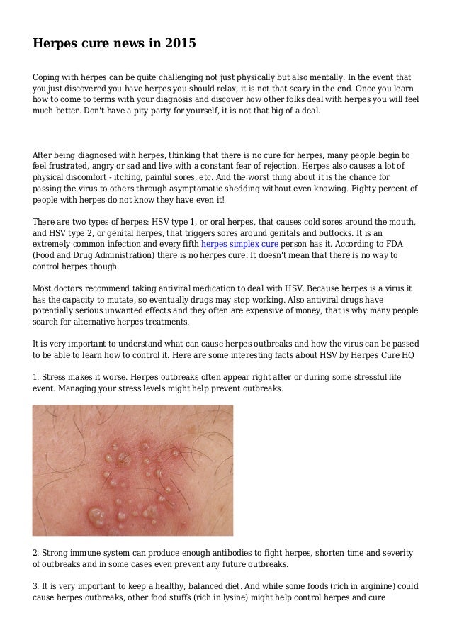 How to deal with herpes mentally